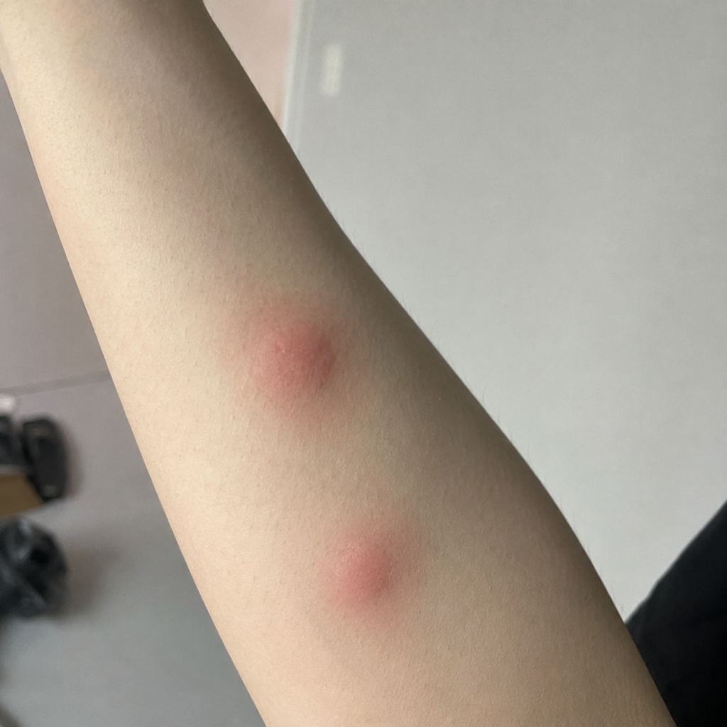 모기는 왜 어떤 사람만 더 물까 